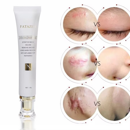 ✨ FATAZEN™ Crème Réparatrice Bio – Anti-Acné, Vergetures & Cicatrices | Soin Naturel Multi-Action ✨