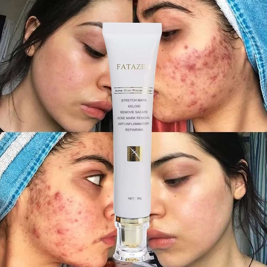 ✨ FATAZEN™ Crème Réparatrice Bio – Anti-Acné, Vergetures & Cicatrices | Soin Naturel Multi-Action ✨